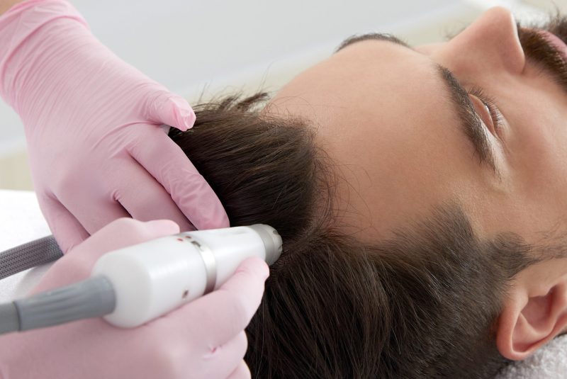 mesotherapie voor haar